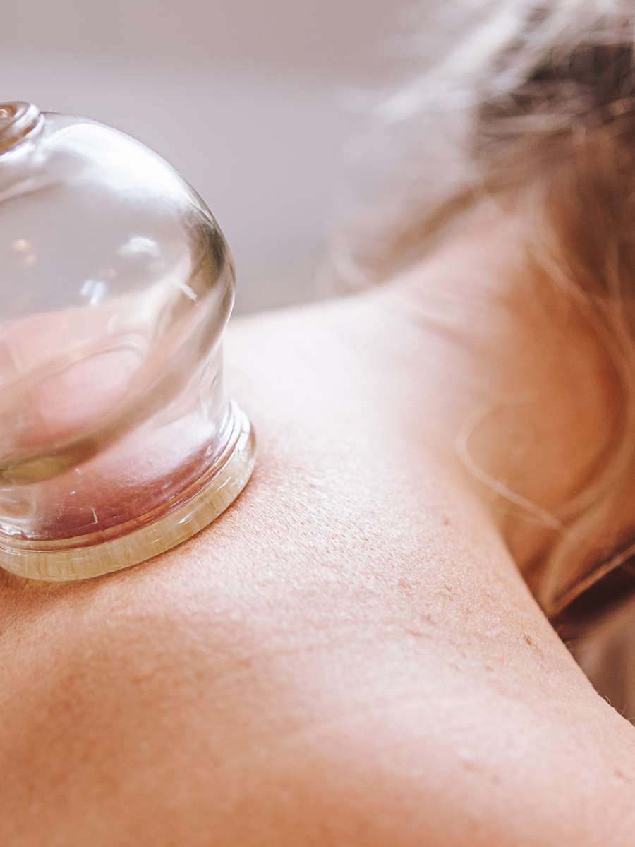 Cupping therapie in Arnhem bij Praktijk voor Oosterse geneeswijzen